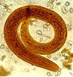  Peneliti Inggris : Cacing Bisa Prediksi Perubahan Iklim di Masa Depan